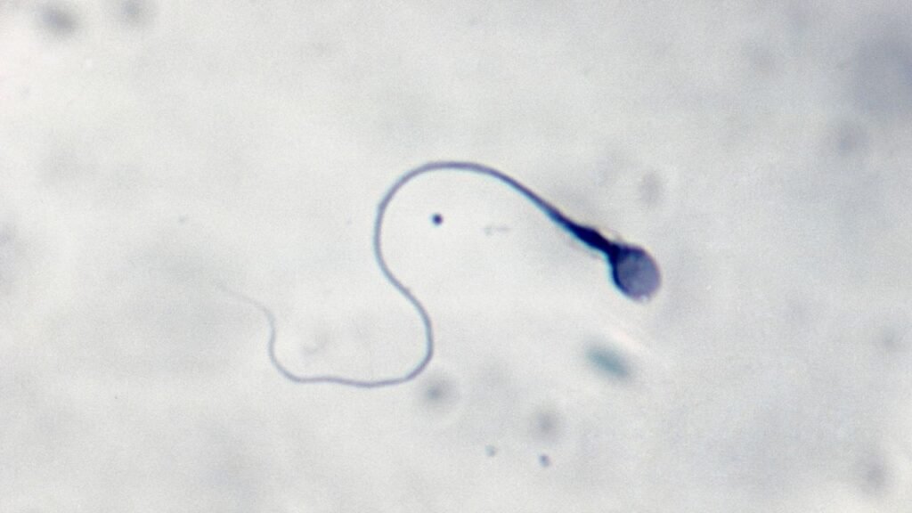 La prima gravidanza al mondo ottenuta grazie all'intelligenza artificiale capace di scovare gli spermatozoi vitali (e a un robot)